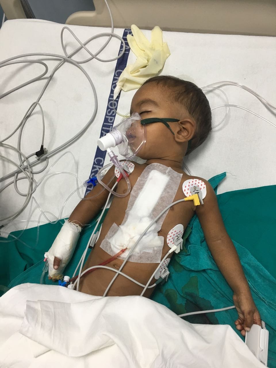 5kg baby operated for Large VSD - DR Sourabh Sharma