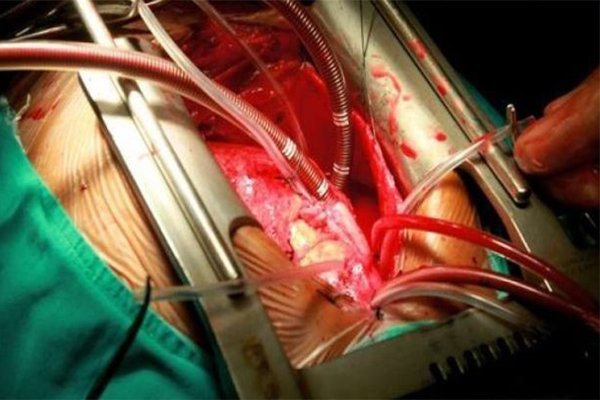 कार्डियोथोरेसिक-सर्जरीज1.jpg